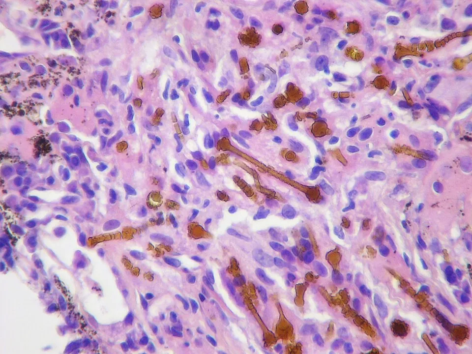 Asbestos under the microscope