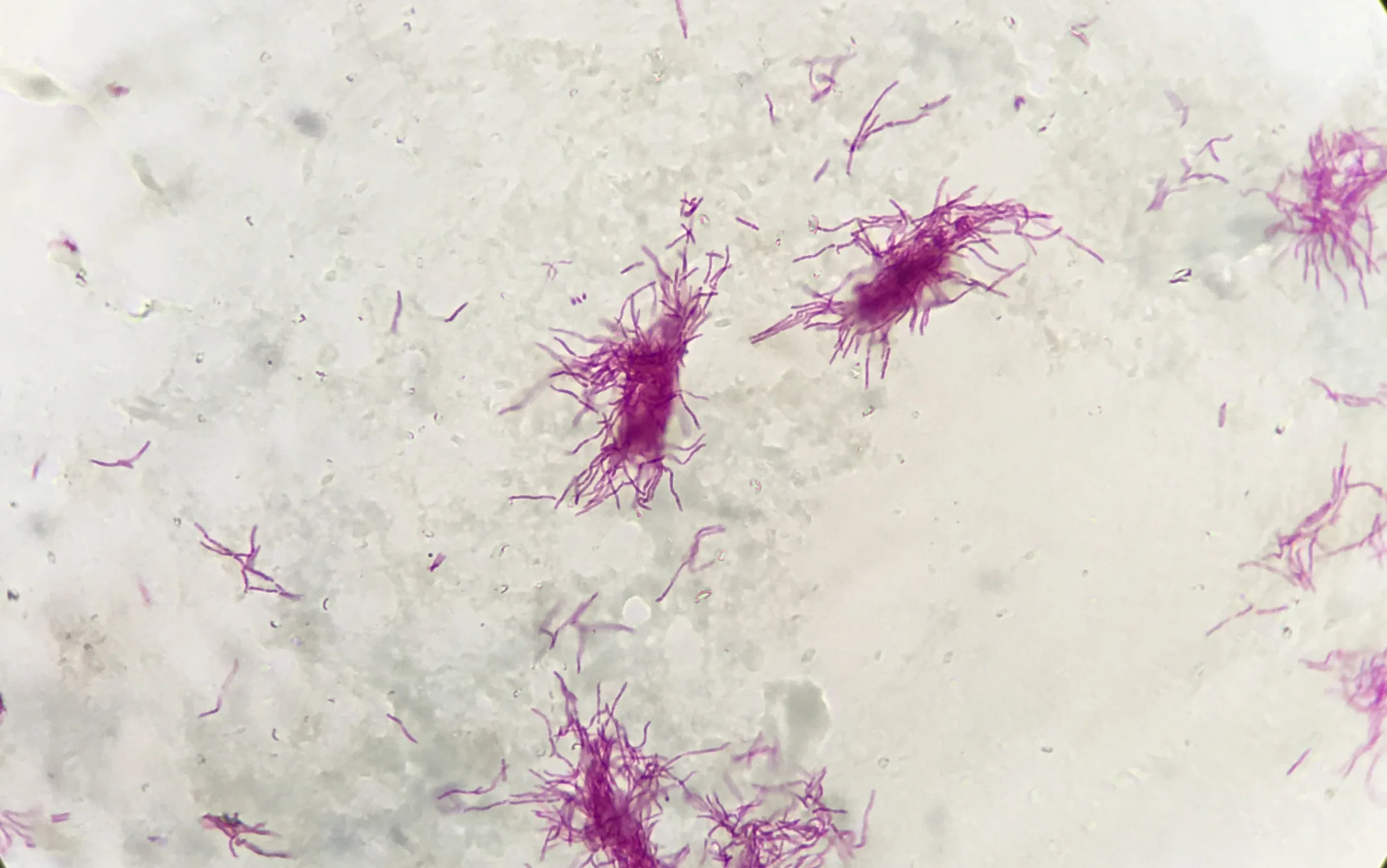 Nocardia spp. under the microscope