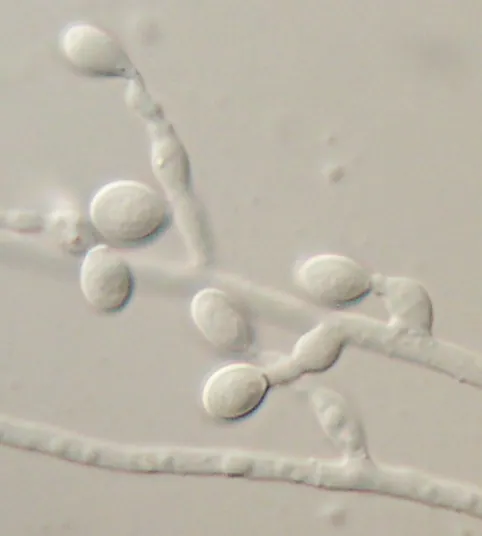 Scedosporium spp. under the microscope