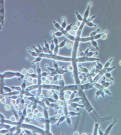 Trichoderma harzianum under the microscope