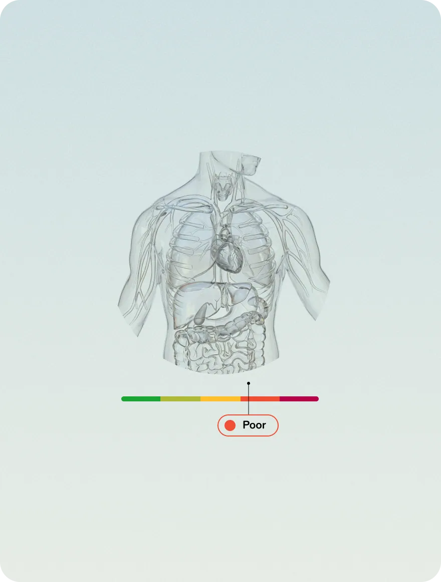 A body diagram with a Lution Level scale marking a Poor level