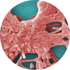 Legionella
